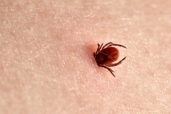 Sindromul alfa-gal: Impactul mușcăturilor de căpușă asupra sănătății umane