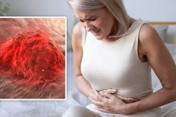 Semnele Ascunse ale Cancerului Intestinal: Ce Trebuie Să Știi pentru a Te Proteja