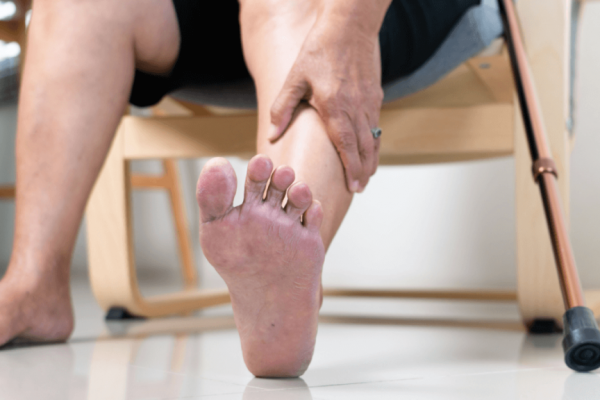 Piciorul Diabetic: O Complicație Severă a Diabetului și Semnele Care Nu Trebuie Ignorate