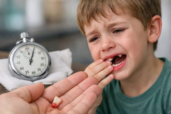 Ce trebuie să faci în cazul avulsiilor dentare la copii: Ghid esențial pentru părinți