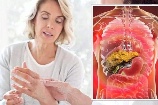 Semnele Ascunse ale Ficatului: Cum Pot Palma și Unghiile Să Îți Salveze Viața