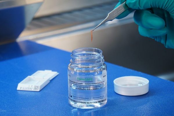 Impactul formalinei asupra conservării țesuturilor: Beneficii și riscuri pentru sănătate