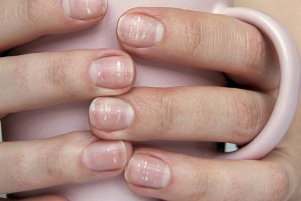 Semnele de pe unghii care pot indica boli cardiovasculare grave: Ce trebuie să știm