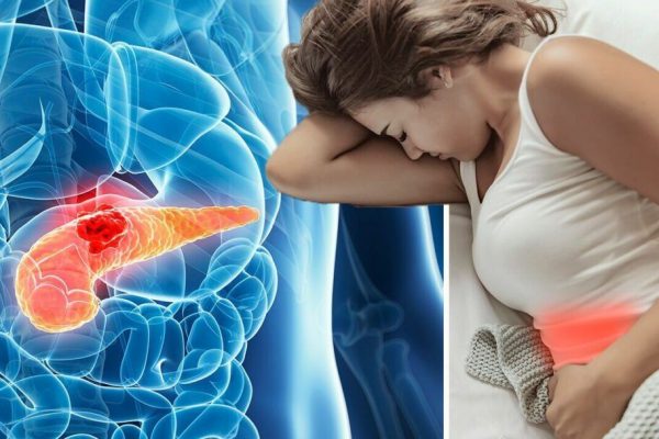 Creșterea alarmantă a cancerului pancreatic în rândul femeilor sub 55 de ani: cauze, riscuri și semne de avertizare