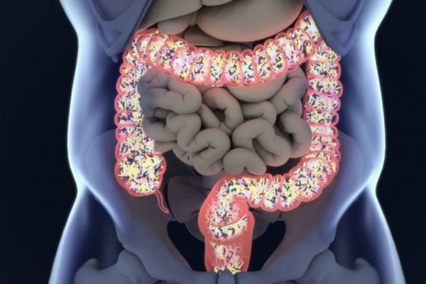 Legătura surprinzătoare dintre sănătatea intestinului și vederea: Perspectivele unui oftalmolog