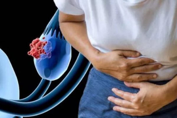 Acordul Johnson & Johnson: O soluție controversată pentru procesele legate de pudra de talc și cancerul ovarian