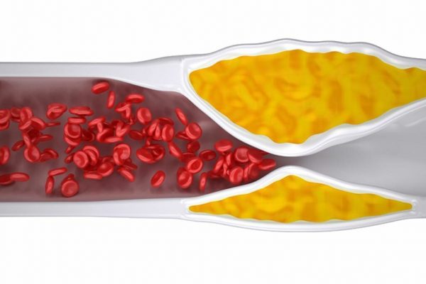 Alimentele care pot reduce trigliceridele în mod natural: Ghid complet pentru sănătate după 50 de ani