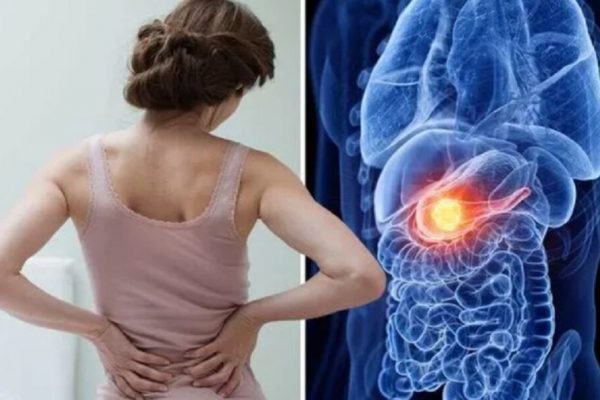 Semnele Tăcute ale Cancerului de Pancreas: 5 Simptome Care Nu Trebuie Ignorate