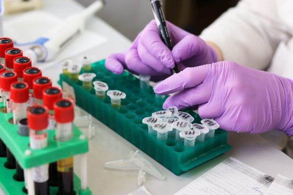 Schimbări esențiale în sistemul de decontare a analizelor medicale: Ce trebuie să știe românii