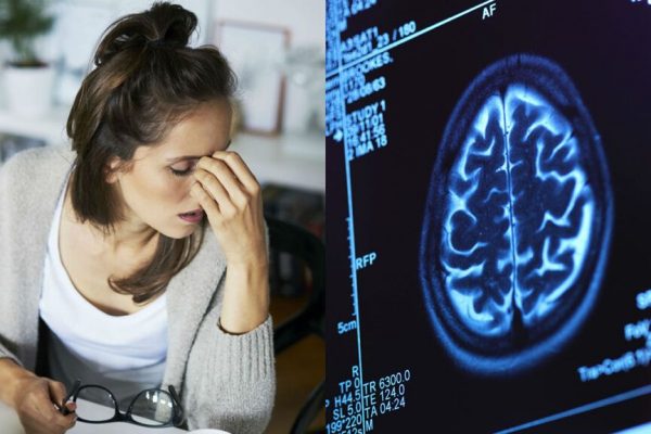 Impactul canabinoidelor asupra tratamentului glioblastomului: O descoperire controversată