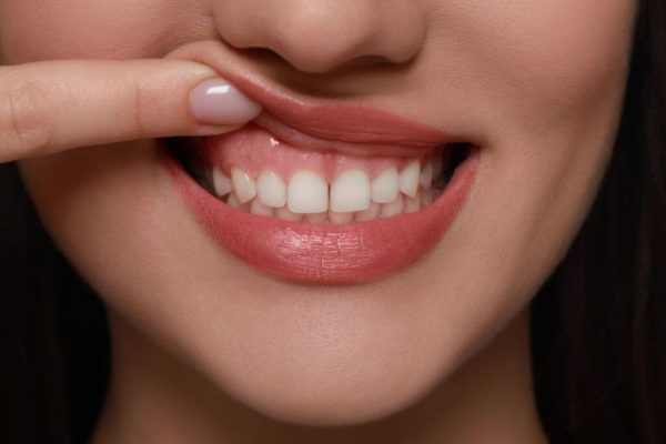 Semnele retragerii gingivale: o problemă de sănătate mai profundă decât pare