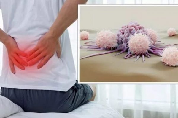 Cancerul Pancreatic: Semnele Tăcute și Importanța Detectării Timpurii
