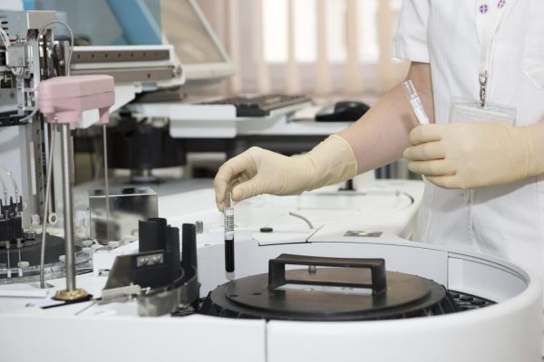 Importanța Analizelor Anuale pentru Diabetici: Cum Pot Preveni Afectarea Rinichilor