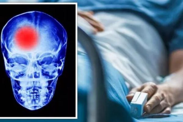 Criza Neurologică din Prahova: Un Spital în Dificultate și Impactul Asupra Pacienților cu AVC