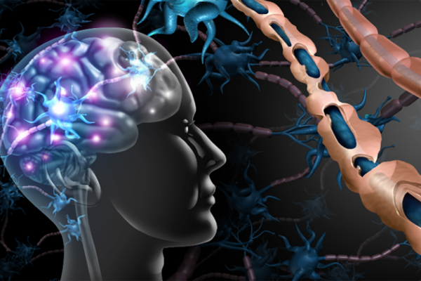 Inteligența Artificială și Viitorul Diagnosticului Alzheimer: O Revoluție în Sănătate