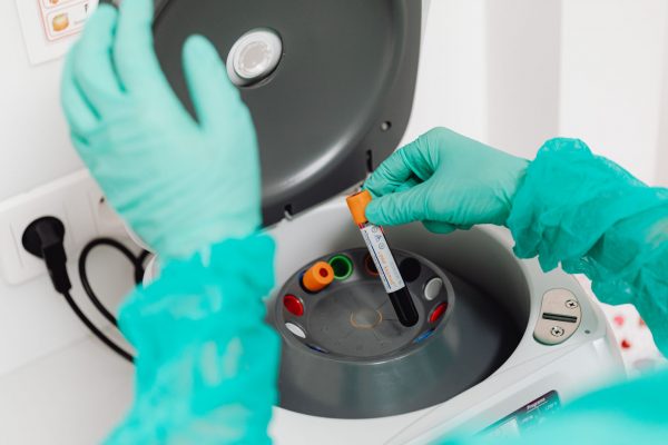 Avansuri Promițătoare în Terapia Personalizată pentru Melanom: Vaccinul ARN Mesager Își Demonstrează Eficiența