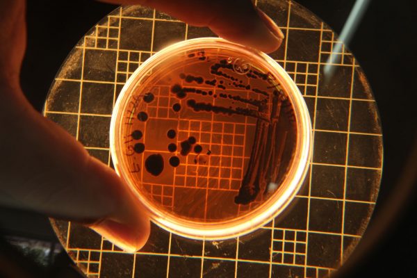 Legătura neașteptată dintre Helicobacter pylori și cancerul colorectal: O analiză detaliată