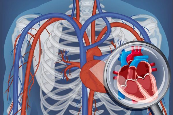 Ischemia Silențioasă: O Provocare Subestimată pentru Sănătatea Cardiovasculară
