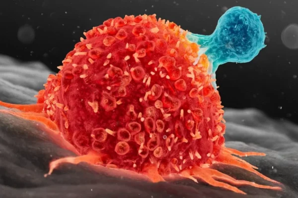 Revoluția în Tratamentul Cancerului: Regresia Completă a Cancerului Metastatic la un Copil prin Terapia CAR-T