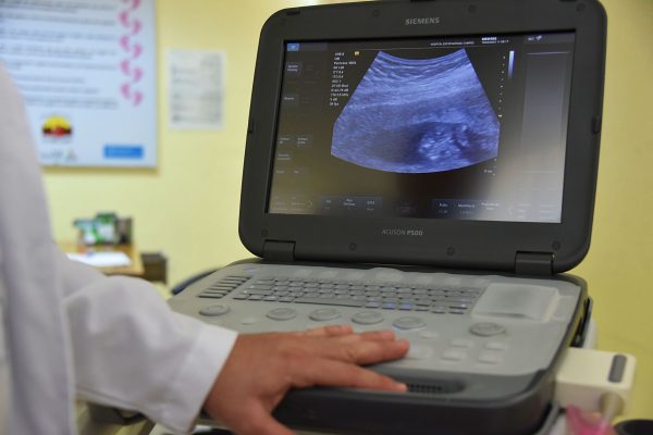 Revoluția în depistarea cancerului pancreatic: Testul de sânge care promite diagnosticare timpurie