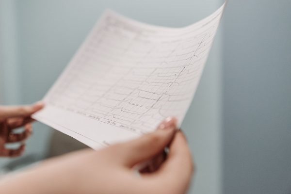 Alimentele albe și impactul lor asupra sănătății cardiovasculare: Ce spune un cardiolog renumit