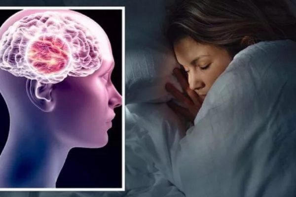 Cum Somnul Profund Contribuie la Eliminarea Deșeurilor Cerebrale Asociate cu Alzheimer: O Privire Detaliată asupra Sistemului Glimfatic
