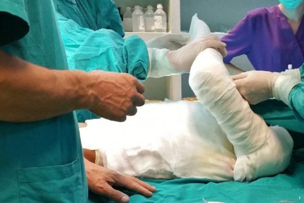 Impactul devastator al arsurilor extinse: O analiză a cazului bărbatului rănit în explozia din București