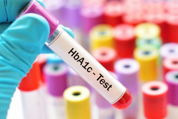 Prediabetul Ascuns: Cum Analiza HbA1c Poate Salva Vieți prin Depistarea Timpurie