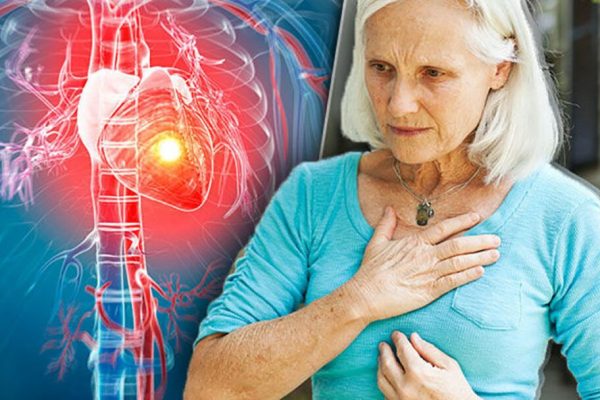 Noua clasificare a insuficienței cardiace: Un ghid esențial pentru prevenție și tratament