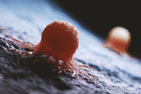 Semnele Tăcute ale Cancerului de Vezică Urinară: Importanța Depistării Precoce și Conștientizării Simptomelor